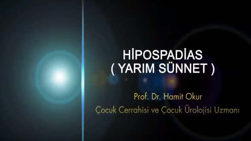 Hipospadias Yarım Sünnet — bilgilendirme görseli
